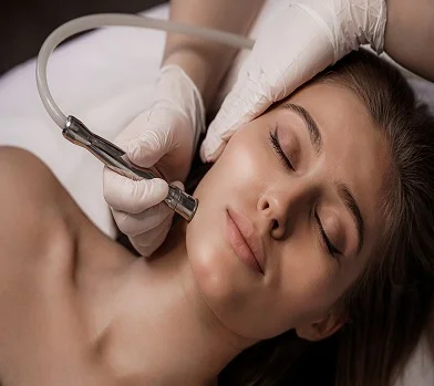 The Benefits of Diamond Microdermabrasion